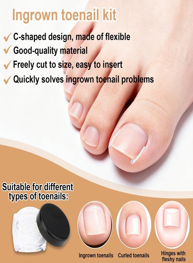 Sinbana 55pcs Ingrown Toenail Set, Include Breathable In-Growing Toenail Strips Curved Toes Patches Lifting Pedicure Tools & Pads Suitable for Home Pedicure - Image 4
